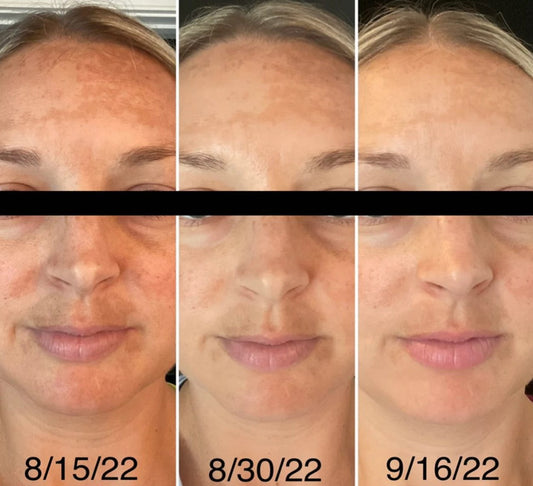 Why You Should Use Beef Tallow For Skincare